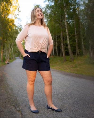 Jenny opererade lipödemben